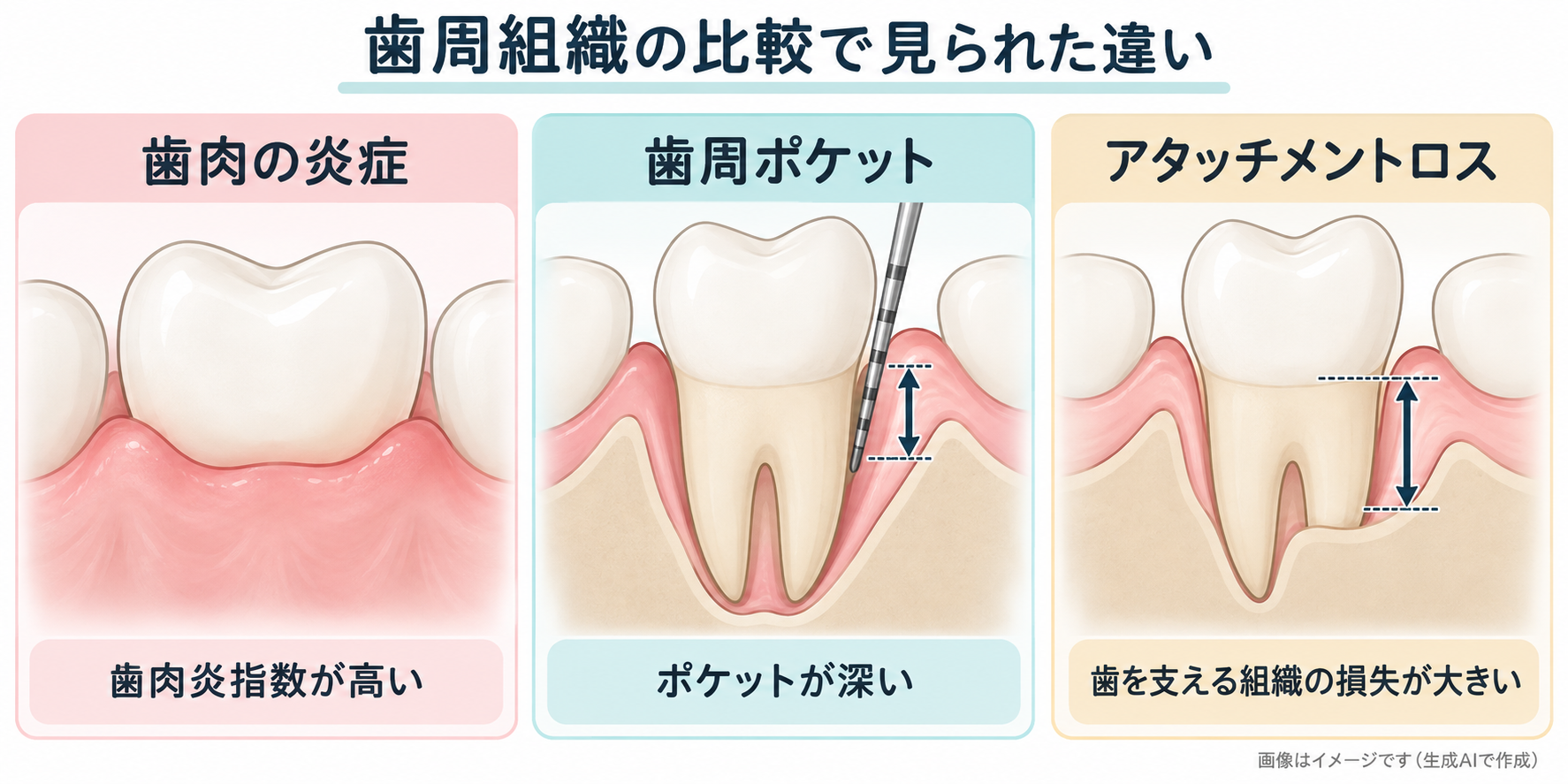 閉経後の比較グループで高かった歯肉炎指数、歯周ポケットの深さ、アタッチメントロスの説明